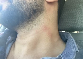 Adana’da gazeteciler alıkonularak, darp edildi