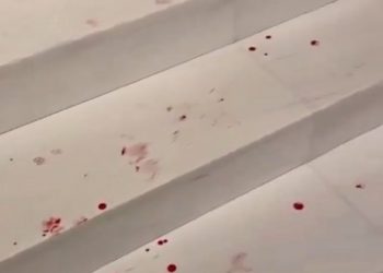 Meclis’te kan aktı: DEM Partili Gülistan Kılıç Koçyiğit’in kaşı açıldı!